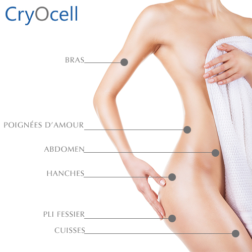 zones-traitees-cryolipolyse